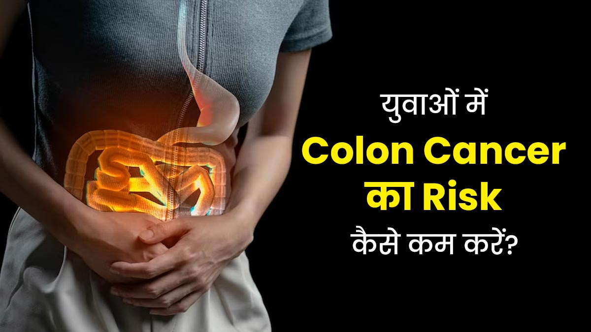 युवाओं को कोलन कैंसर से बचने के लिए क्या करना चाहिए? बता रहे हैं डॉक्टर
